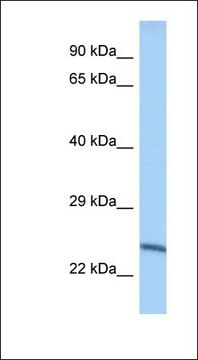 Anti-METTL10 antibody produced in rabbit