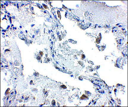 Anti-SH3BP4 antibody produced in rabbit