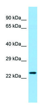 Anti-LHFPL4 (C-terminal) antibody produced in