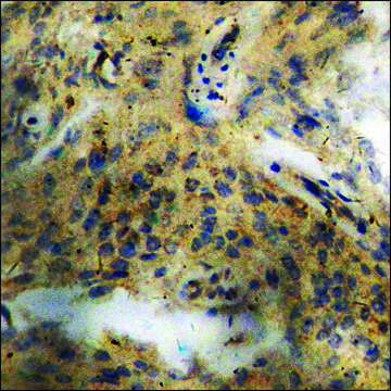Anti-phospho-KIF2C (pSer??) antibody produced in