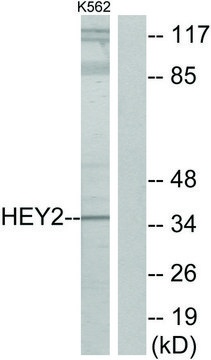Anti-HEY2 antibody produced in rabbit