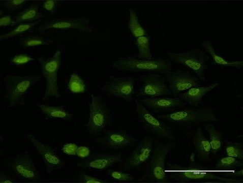 Anti-WDR79 antibody produced in rabbit