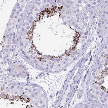 Anti-MON1A antibody produced in rabbit