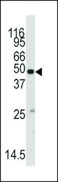 ANTI-METHIONYL TRNA SYNTHETASE(C-TERMINAL) antibody produced