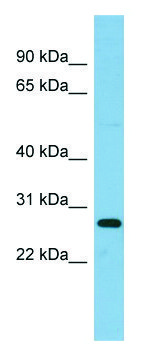 Anti-RPL10A antibody produced in rabbit