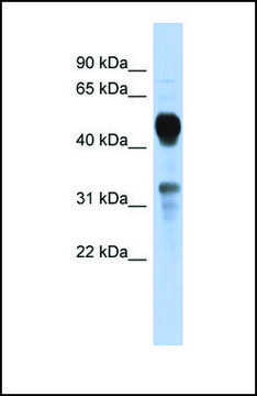 Anti-MVK antibody produced in rabbit
