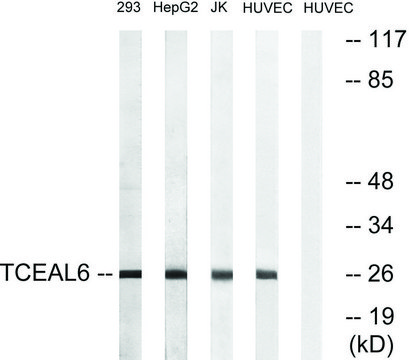 Anti-TCEAL6 antibody produced in rabbit