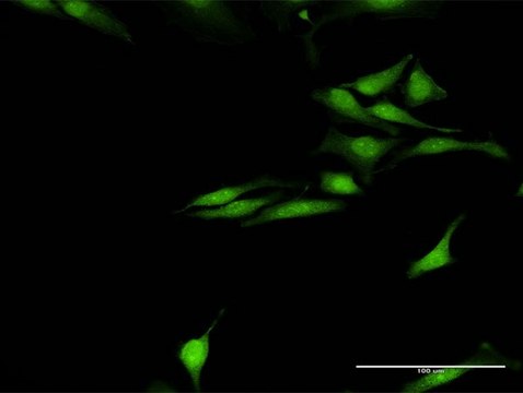 Anti-SNCG antibody produced in rabbit