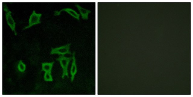 Anti-GRM5 antibody produced in rabbit