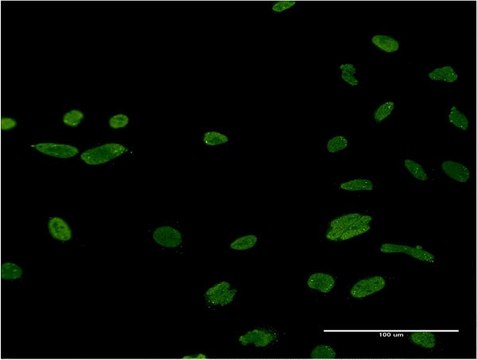 Monoclonal Anti-ASF1B antibody produced in