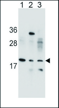 ANTI-VCX1 (N-TERM) antibody produced in