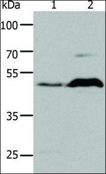 Anti-5HT1A antibody produced in rabbit