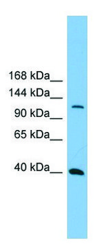 Anti-MAP3K14 (N-terminal) antibody produced in