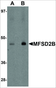 Anti-MFSD2B antibody produced in rabbit