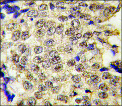 Anti-SMCY (C-term) antibody produced in