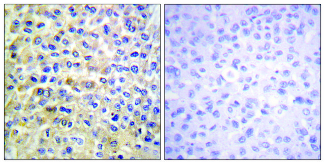 Anti-EGFR antibody produced in rabbit