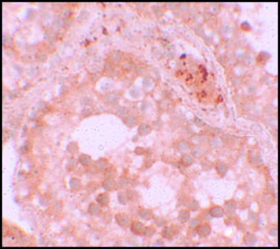Anti-WDR92 antibody produced in rabbit