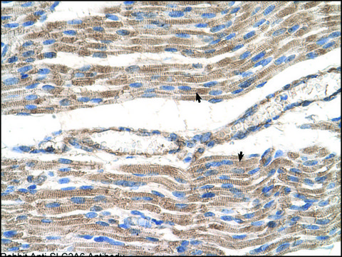 Anti-SLC2A6 antibody produced in rabbit