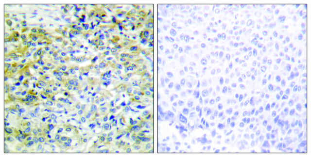 Anti-CARKL antibody produced in rabbit