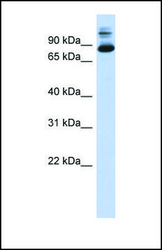Anti-SIX4, (N-terminal) antibody produced in