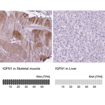 Anti-IGFN1 antibody produced in rabbit