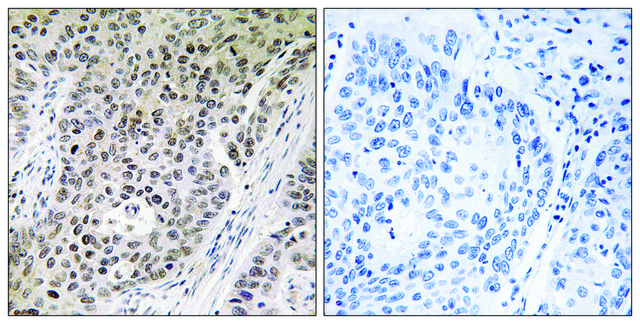 Anti-ZNF608 antibody produced in rabbit
