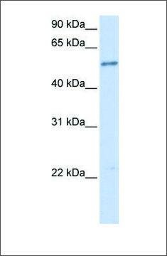 Anti-IL1RL1 antibody produced in rabbit