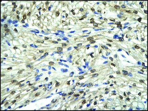 Anti-FLI1 antibody produced in rabbit