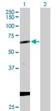 Anti-CPNE1 antibody produced in rabbit