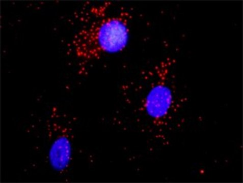 Anti-ACTN1 antibody produced in rabbit