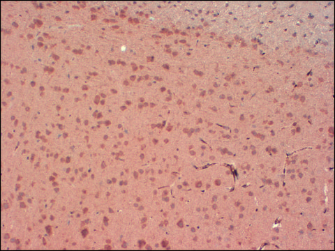 Monoclonal Anti-KCNA4 antibody produced in