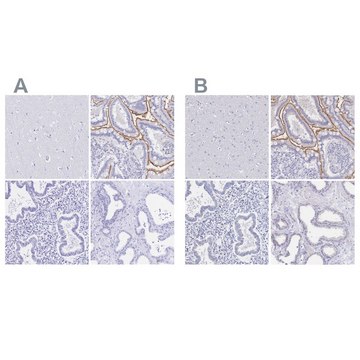 Anti-SLC5A1 antibody produced in rabbit