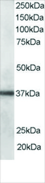 Anti-CLIM1/PDLIM1 antibody produced in goat