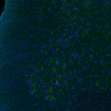 Anti-HTR2B (N-terminal) antibody produced in