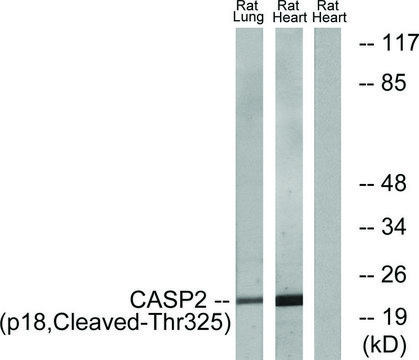 Anti-CASP2 (p18, Cleaved-Thr³²?) antibody produced