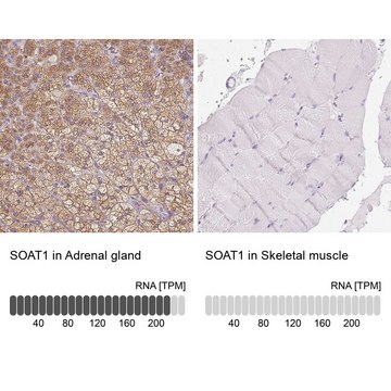 Anti-SOAT1 antibody produced in rabbit