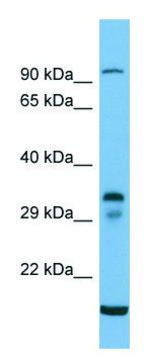 Anti-TM6SF2 (C-terminal) antibody produced in