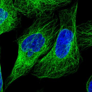 Anti-LARP6 antibody produced in rabbit