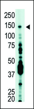 ANTI-USP7 (HAUSP)(C-TERMINAL) antibody produced in