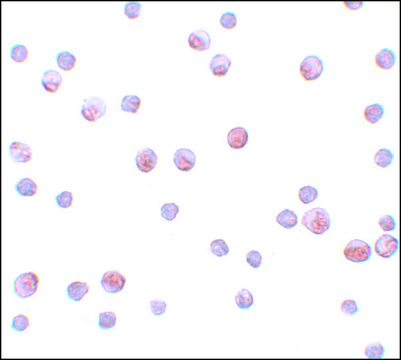 Anti-SIP1 antibody produced in rabbit