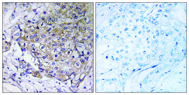 Anti-WASF3 antibody produced in rabbit