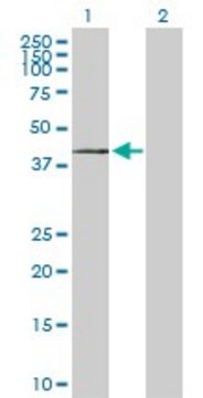 Anti-ST3GAL1 antibody produced in rabbit