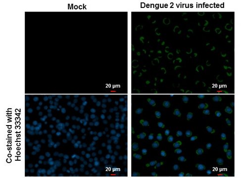Monoclonal Anti-Dengue virus Envelope protein