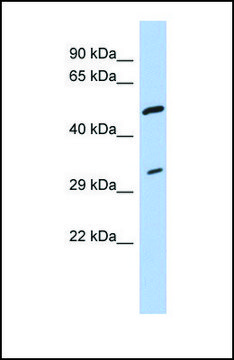 Anti-TPM3 antibody produced in rabbit
