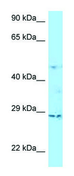 Anti-TNAIP6 (C-terminal) antibody produced in
