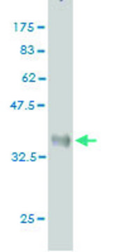 ANTI-ULK2 antibody produced in mouse