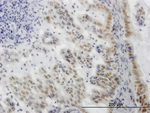 ANTI-SGK antibody produced in mouse