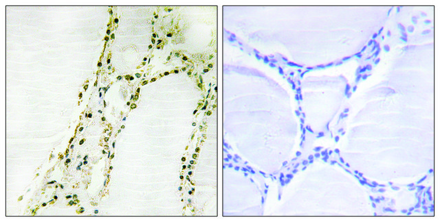 Anti-S6K-?2 antibody produced in rabbit