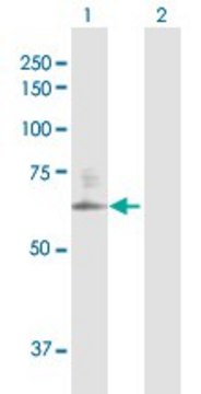 Anti-CSGALNACT2 antibody produced in rabbit