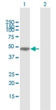 Anti-MAGEA8 antibody produced in rabbit